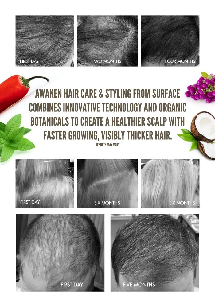 Surface Awaken Therapeutic Shampoo 32 oz
