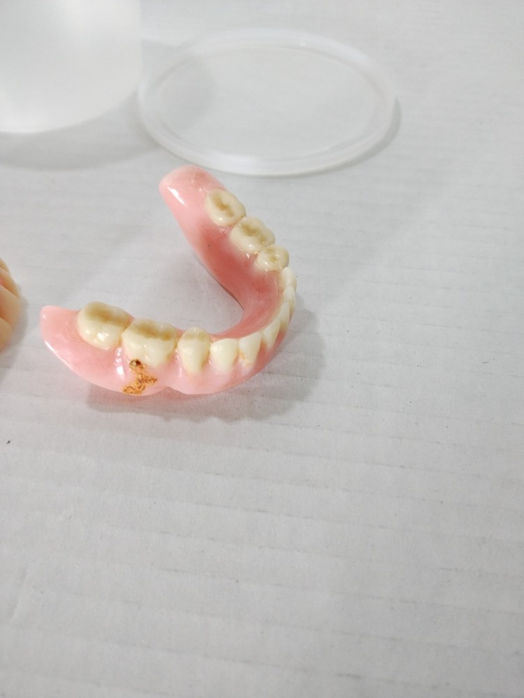 Acrylic Hard Denture Full Denture Kit – Upper & Lower | Generic Size Oddity