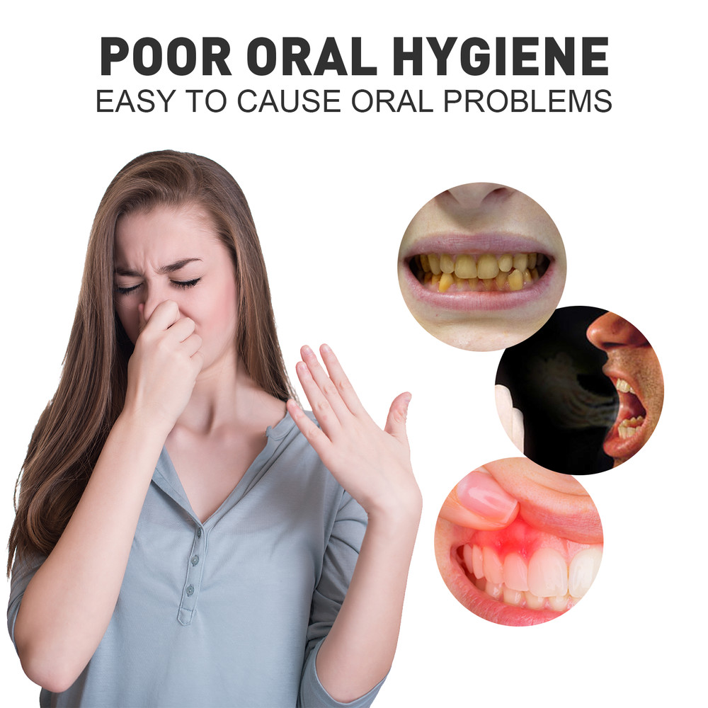 2X Sp-6 Toothpaste SP-6 Probiotic Toothpaste Quick Whitening White Toothpaste