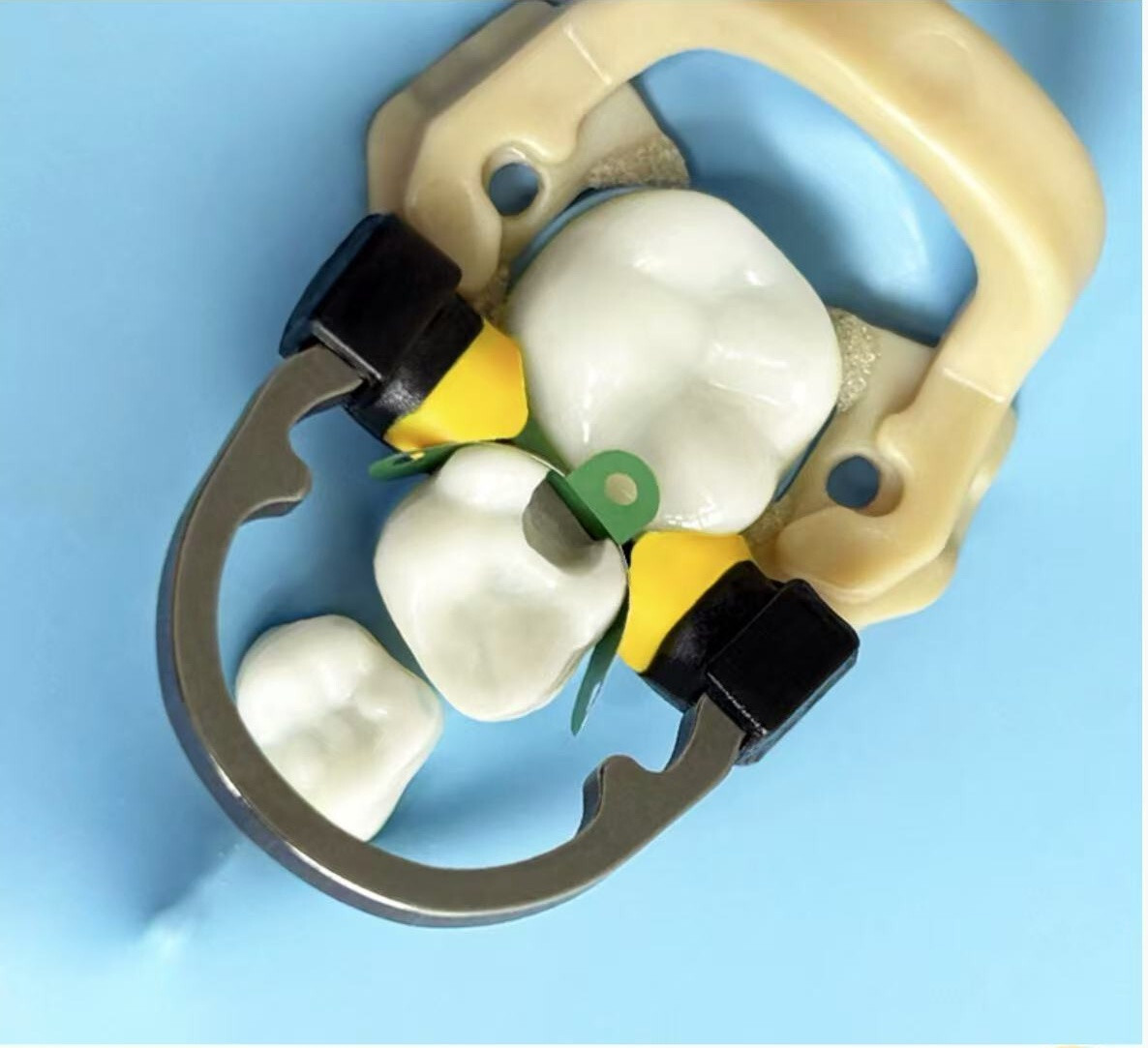 Dental Matrix Bands Ring Sectional Matrice Clamp Fit Garrison Palodent V3 System