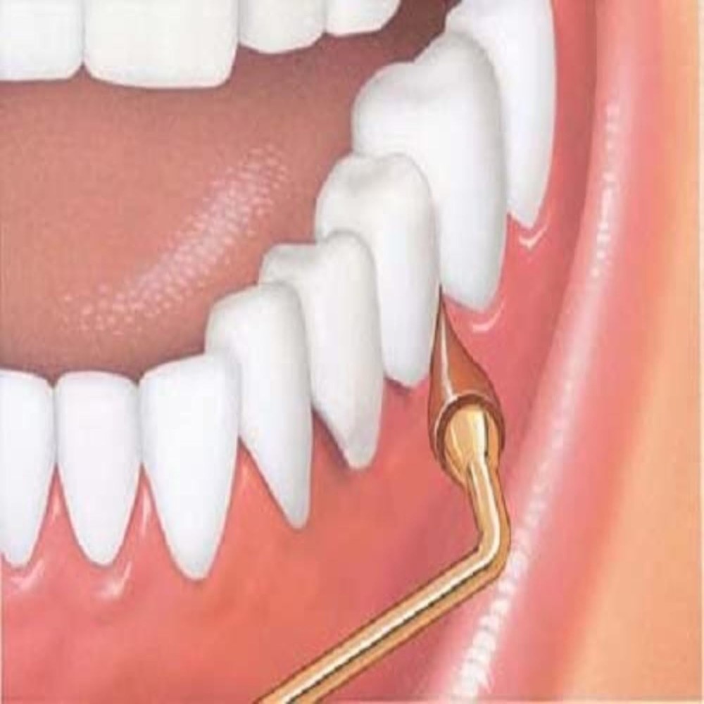 GUM Stimulator Permanent Handle with Rubber Tip, Precision Control, Massages