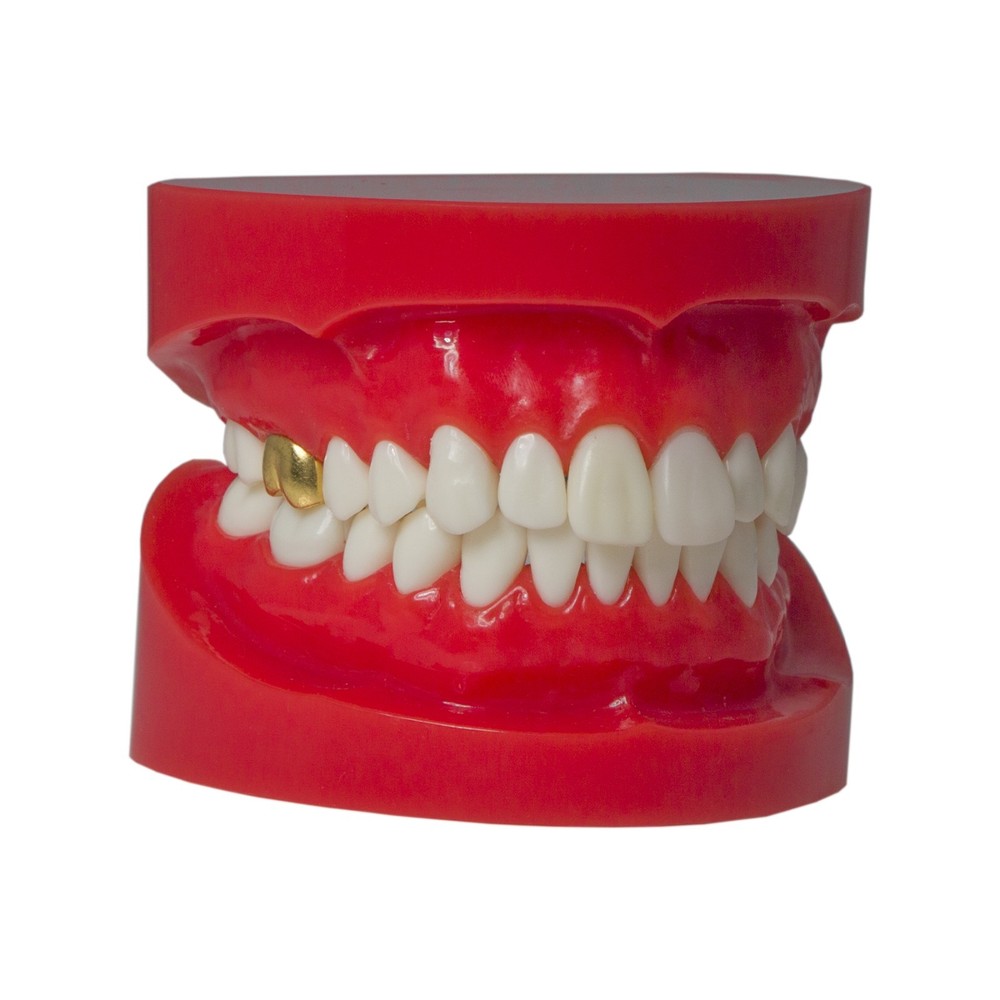 Dental M6004 Teaching Typodont Restoration Teeth Model Crown Post Core Bridge