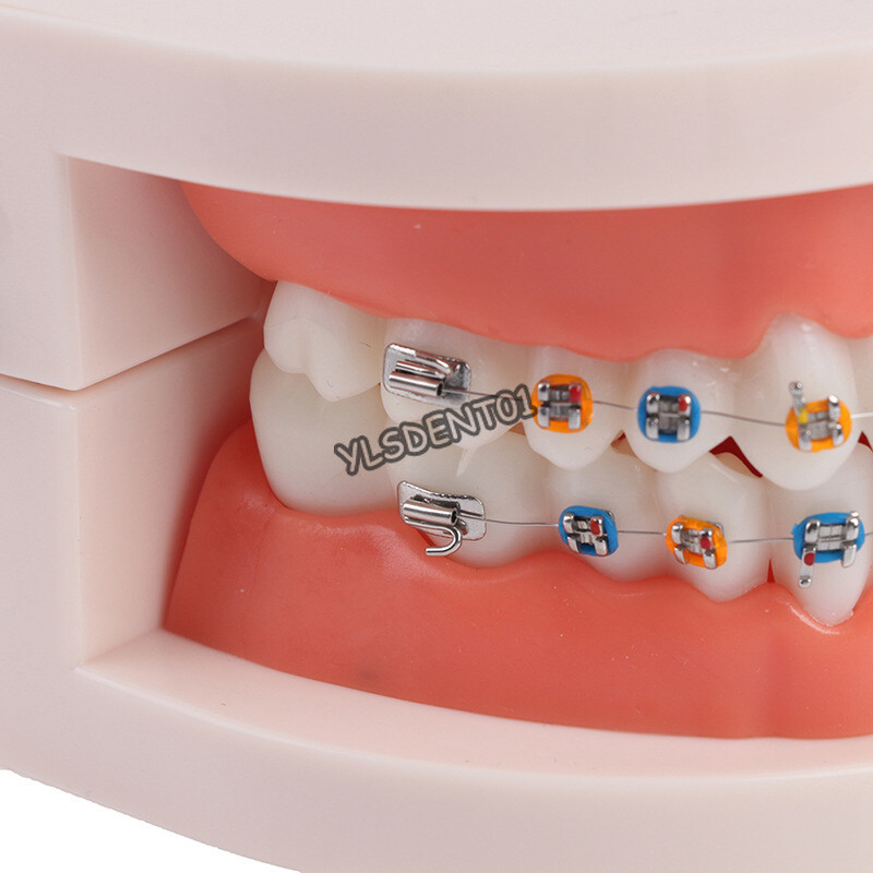 Dental Typodont Orthodontic Treatment Teeth Model Malocclusion Study w/ Bracket