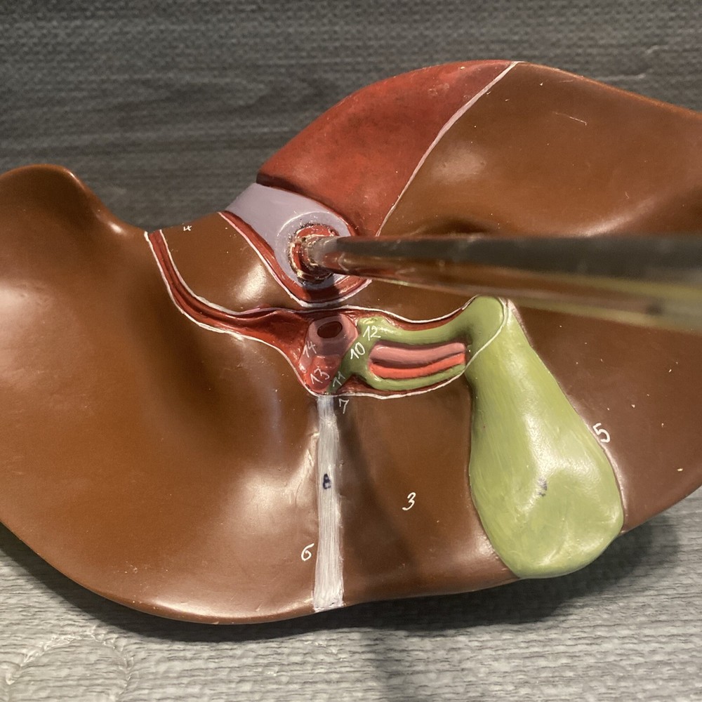 Somso Liver On Adjustable Stand Model - Numbered - Damaged