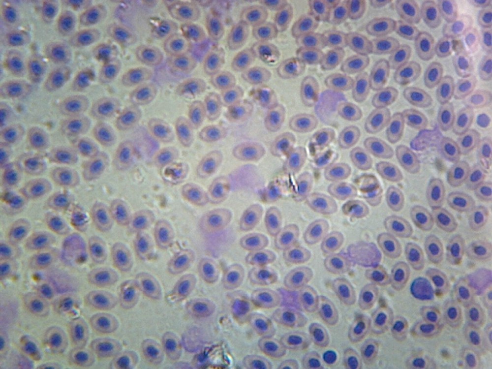 Bird Blood; Smear