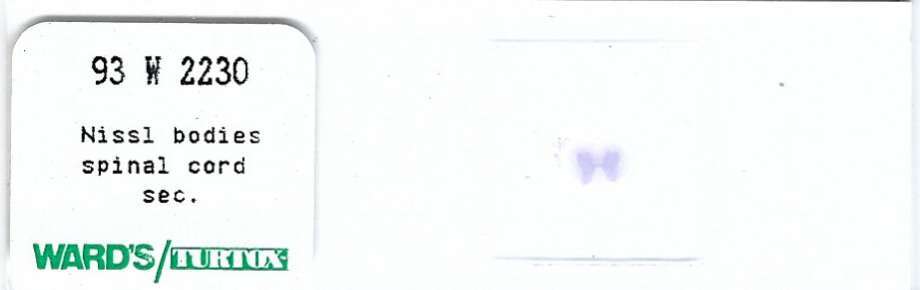 Nissl Bodies in Spinal Cord Microscope Slide