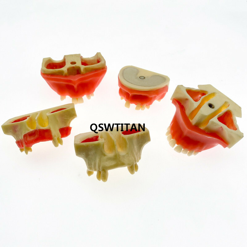 Simulation Typodont Study Model Dental Sinus Lift Practice Teeth / Tooth Model