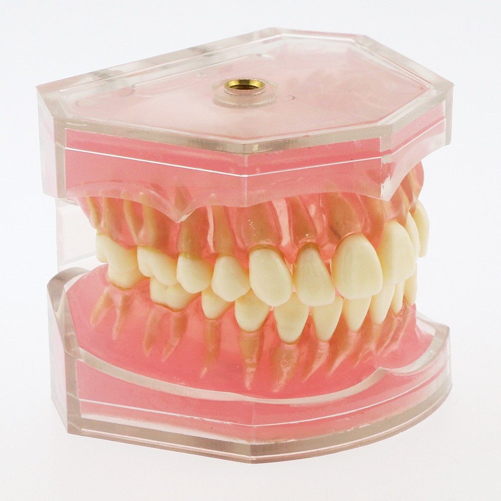 Dental Ortho Standard Teeth Study Demonstration Teaching Model Removable Teeth