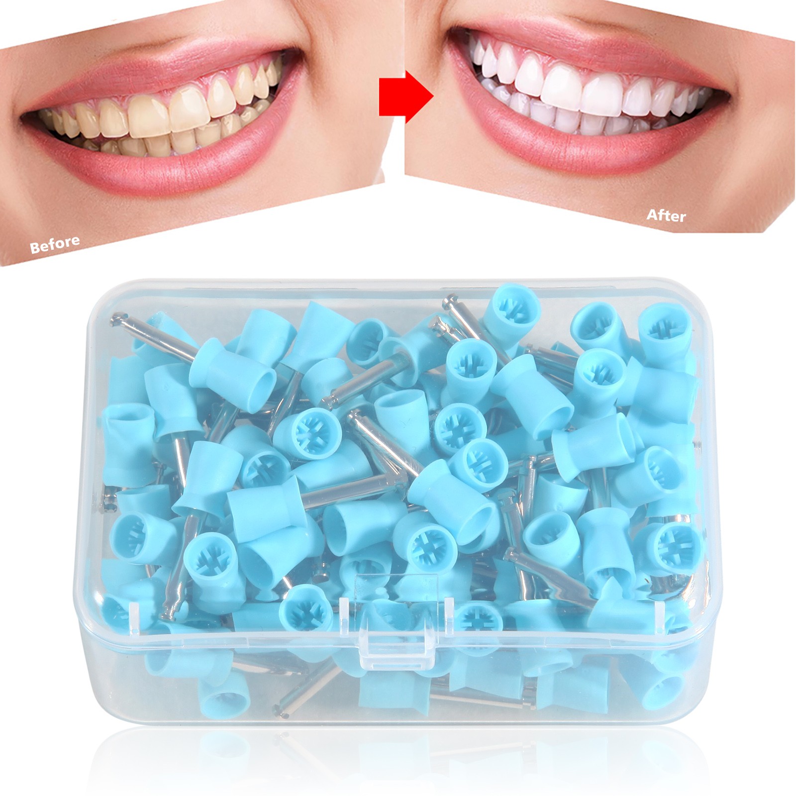 100-1000*Dental Rubber Prophy Tooth Teeth Polish Polishing Cups Latch Type Blue