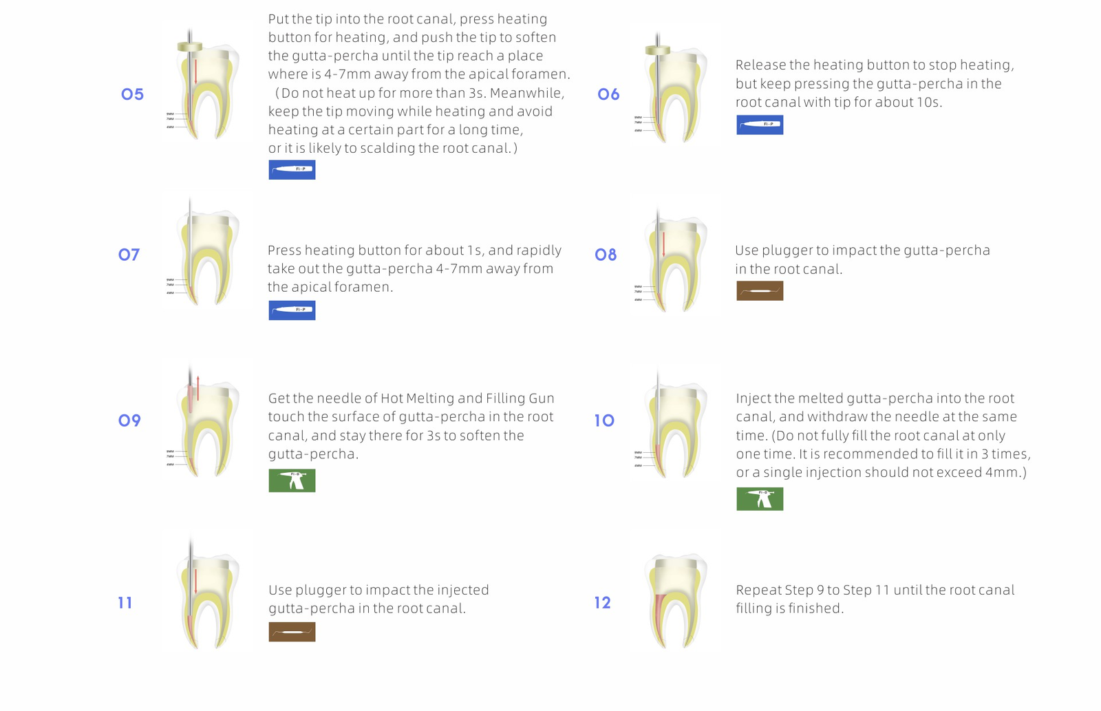 Woodpecker Dental Endodontic Gutta Percha Obturation System Gun & Heated Pen