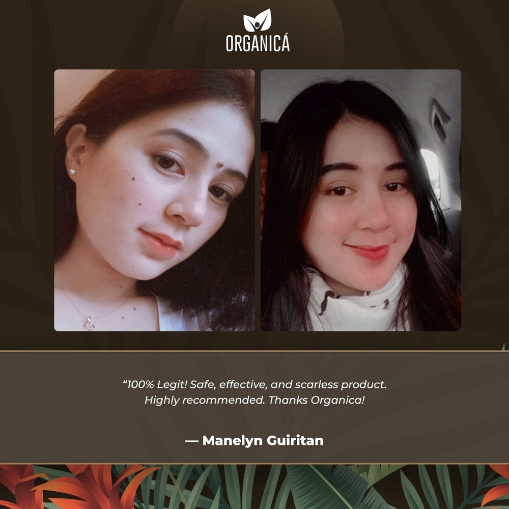 Multi-Awarded Mole and Warts Remover Set