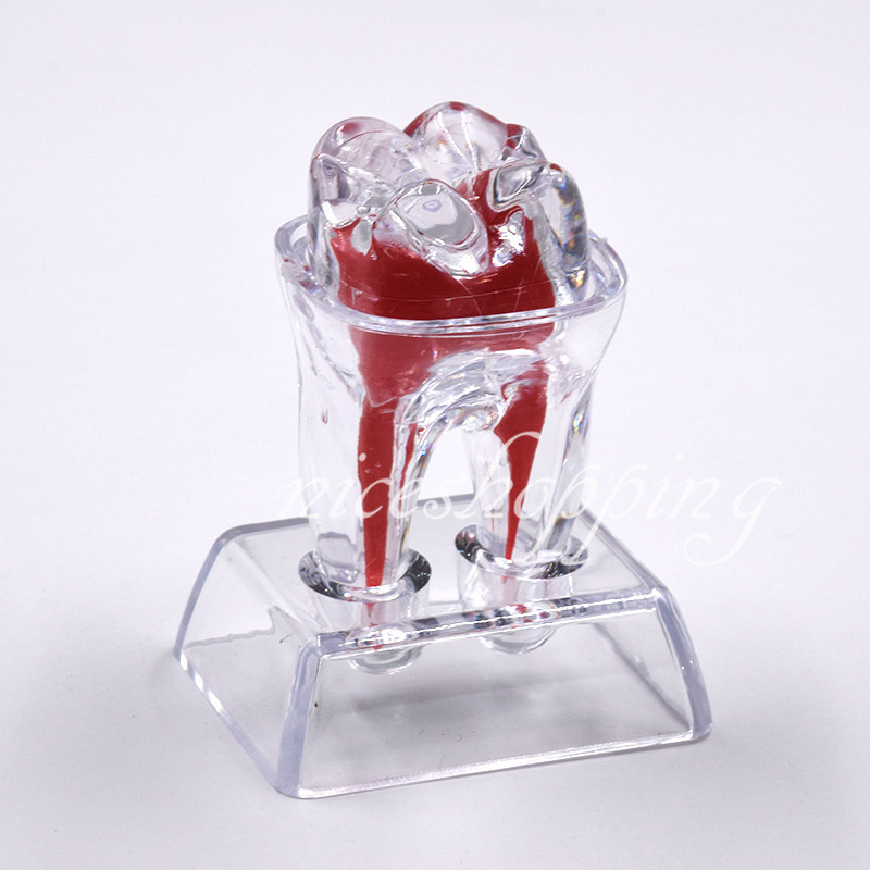 1x Dental Separable Crystal Base Hard Plastic Teeth model Tooth Molar Model