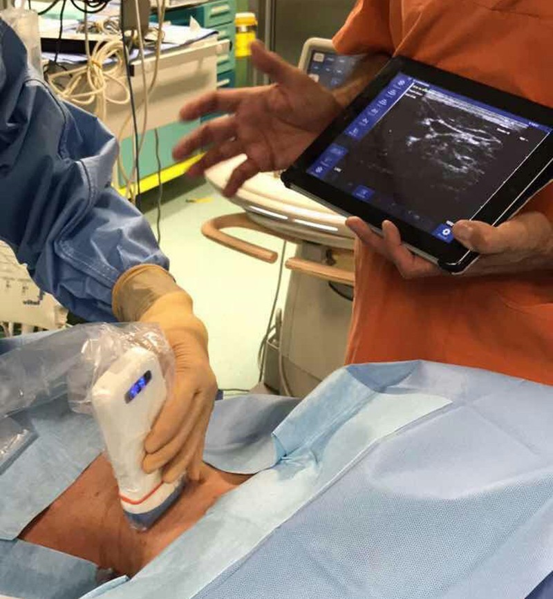 Wireless Linear Palm B/W Ultrasound Scanner – Portable Probe Type, 128 Elements
