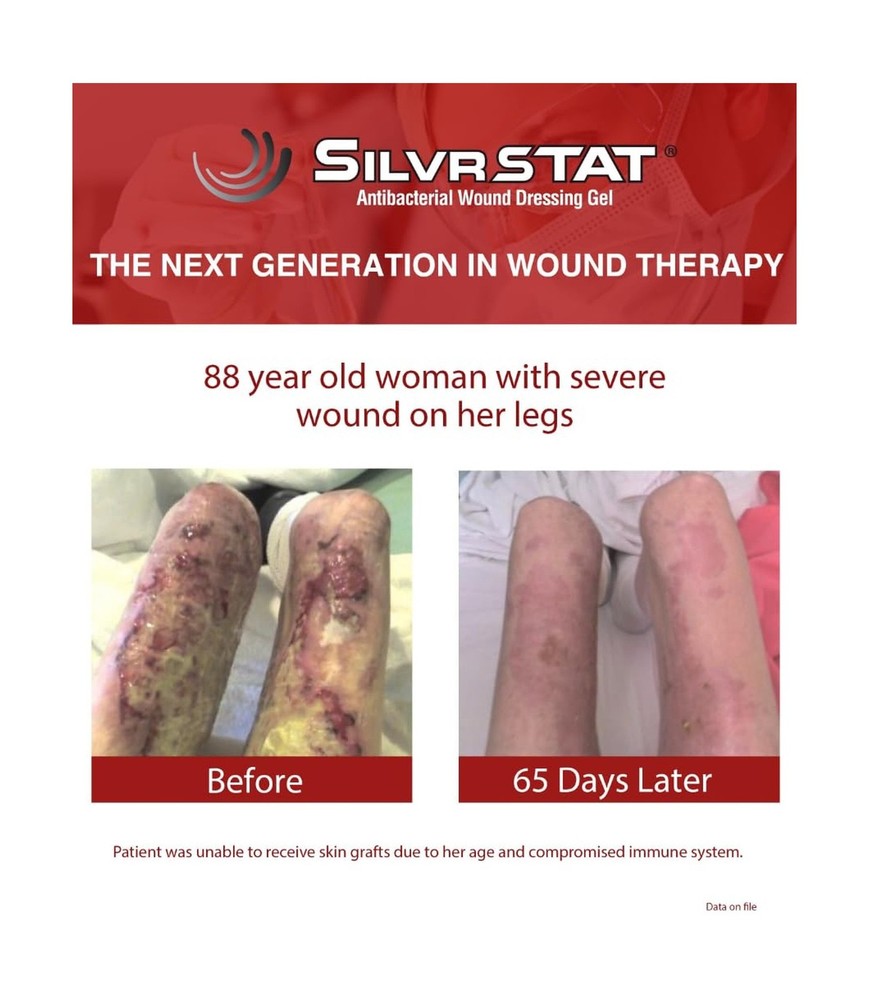 SilvrSTAT First Aid Kit Gel | 32 PPM Silver Healing Wound Dressing Solution |...