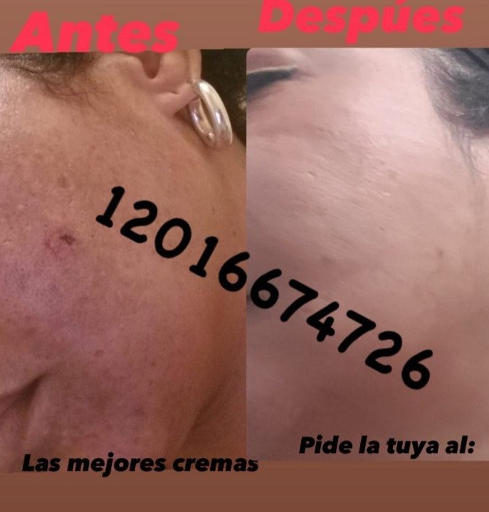 Cremas Blanqueadora Doña Iris