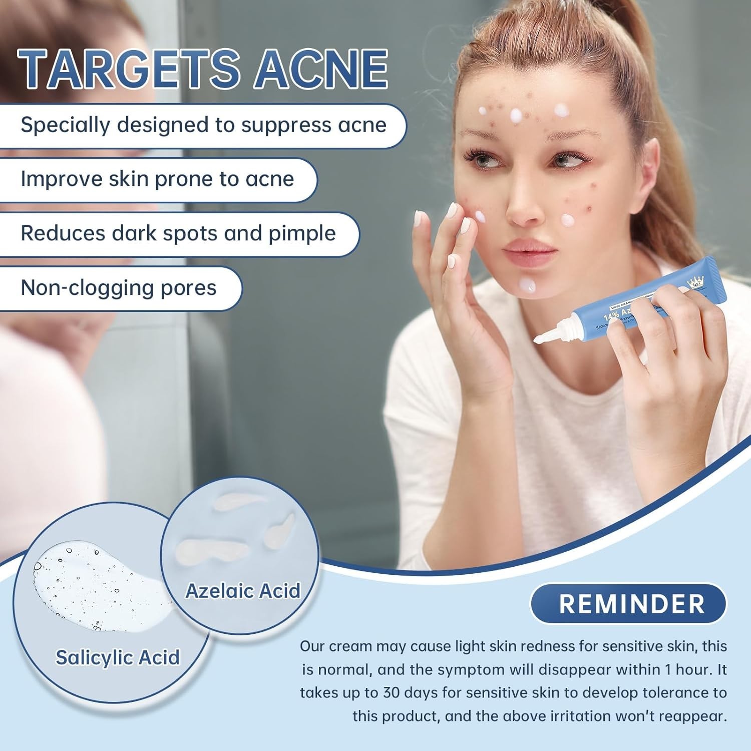 Azelaic Acid 14% Acne Cream for Redness Relief, Dark Spots, Facial Serum with Ni