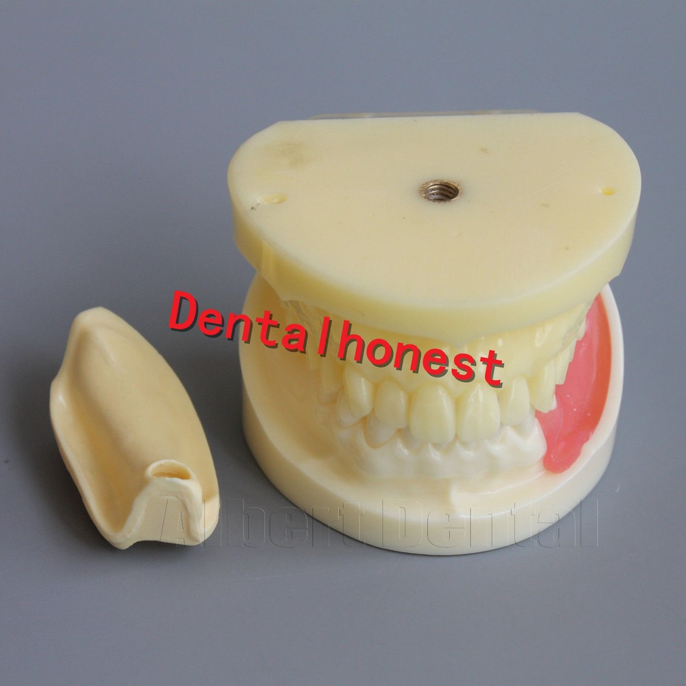 Great Dental Full Implant Drilling Practice Teeth Study Model Typodont Model