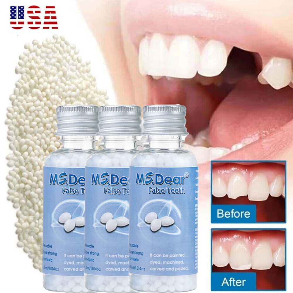 Tooth Solid Gel Temporary Moldable Repair Kit Thermal Fitting Bead Teeth 5x30ml