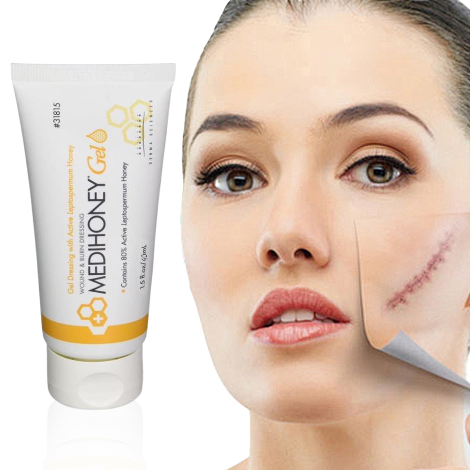 MediHoney - 1.5 oz Gel Wound & Burn Dressing Tube Medical Grade Honey