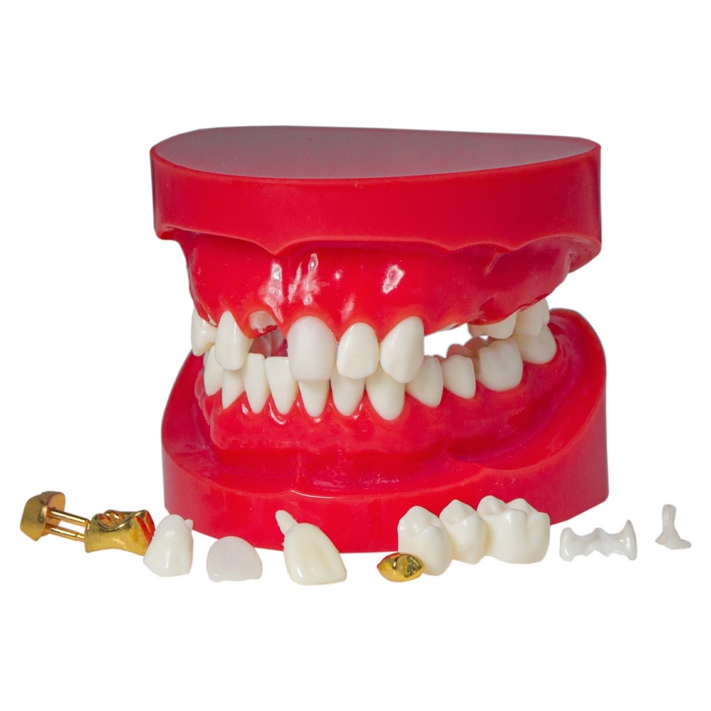 Dental M6004 Teaching Typodont Restoration Teeth Model Crown Post Core Bridge