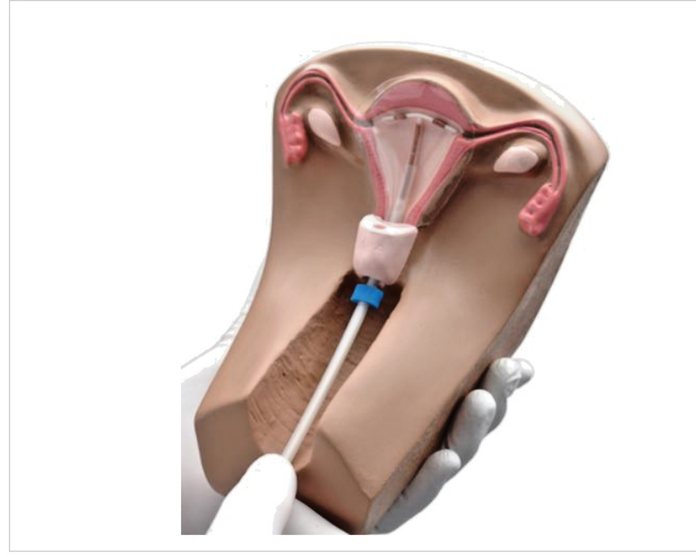 Female Pelvic Organs Model