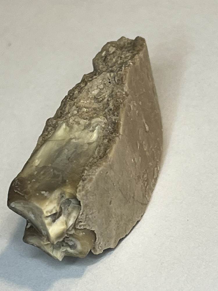 Oriodant Teeth In Jaw Bone #4
