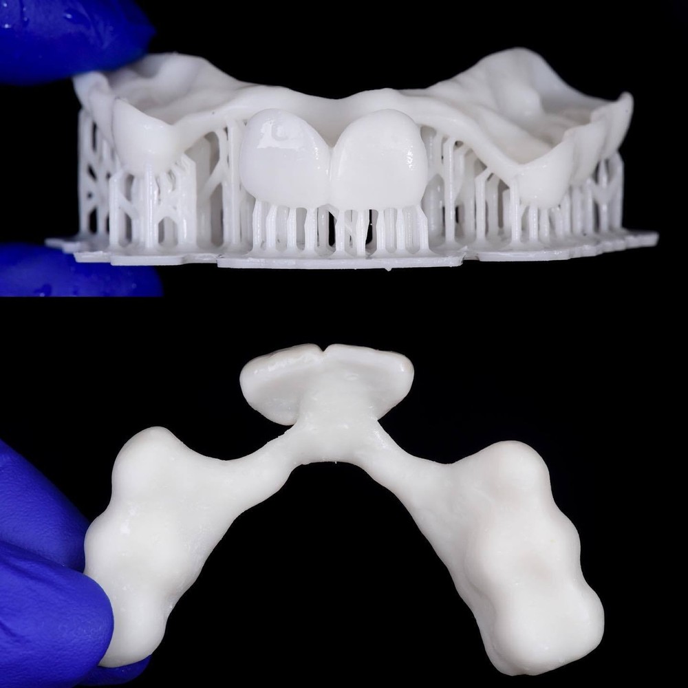 DLP SLA LCD 3d printer TRY-IN - dentures and teeths testings