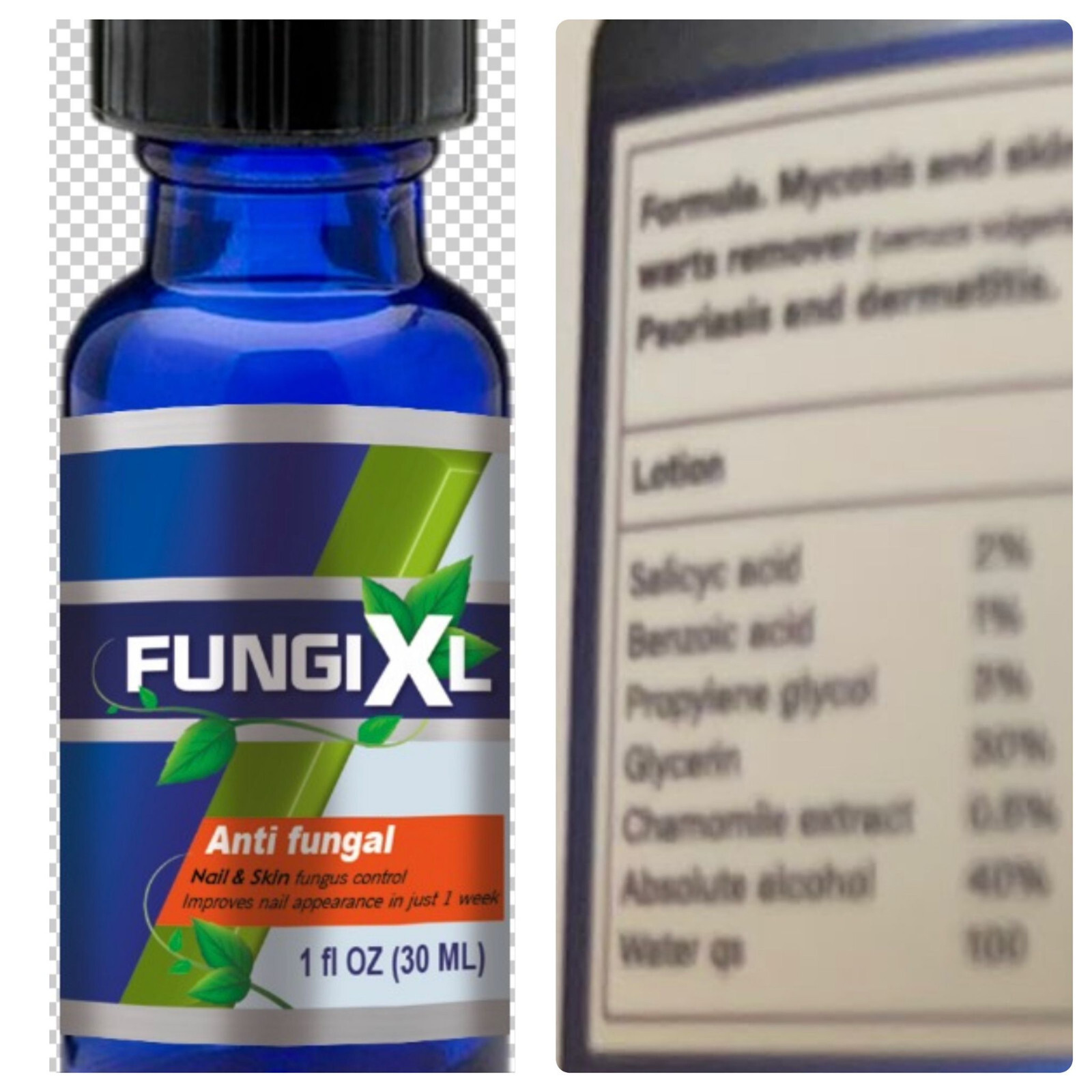 FUNGI XL ANTIFUNGAL CL EXTRA STRENGTH FUNGUS NAILS Support