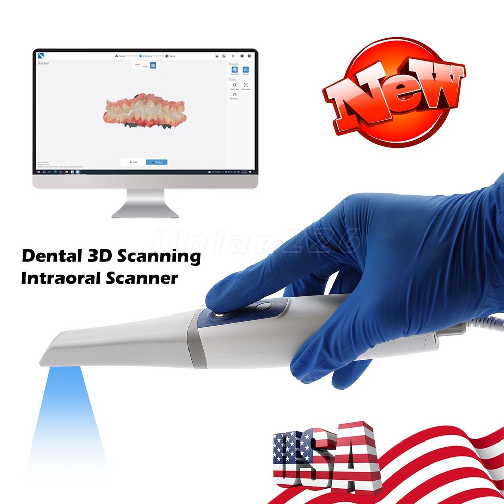 Digital Impressionist Intraoral Scanner Open Data for Prosthetics Implants Ortho