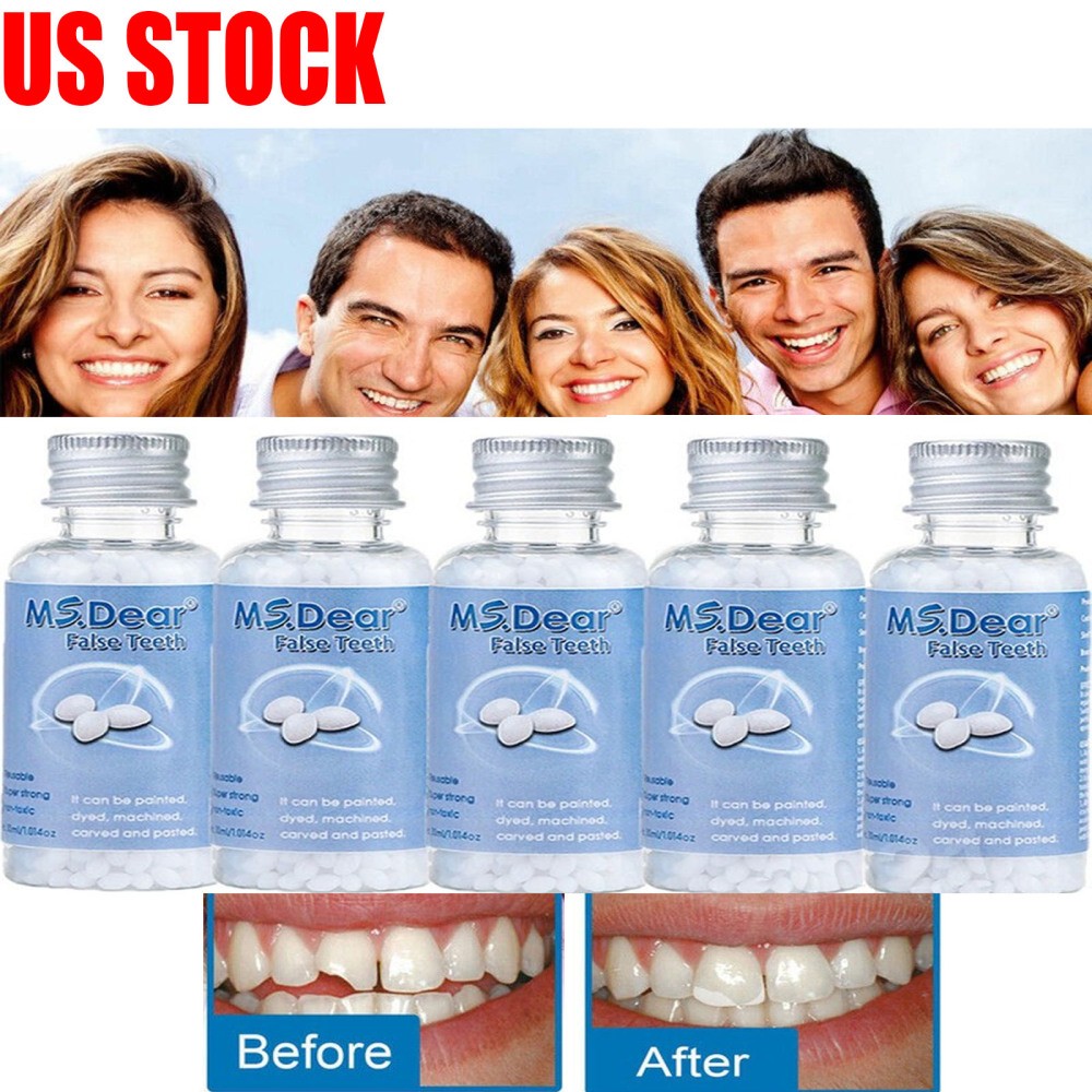 1-5X Tooth Repair Granules Temporary Fitting Beads Reusable Moldable False Teeth