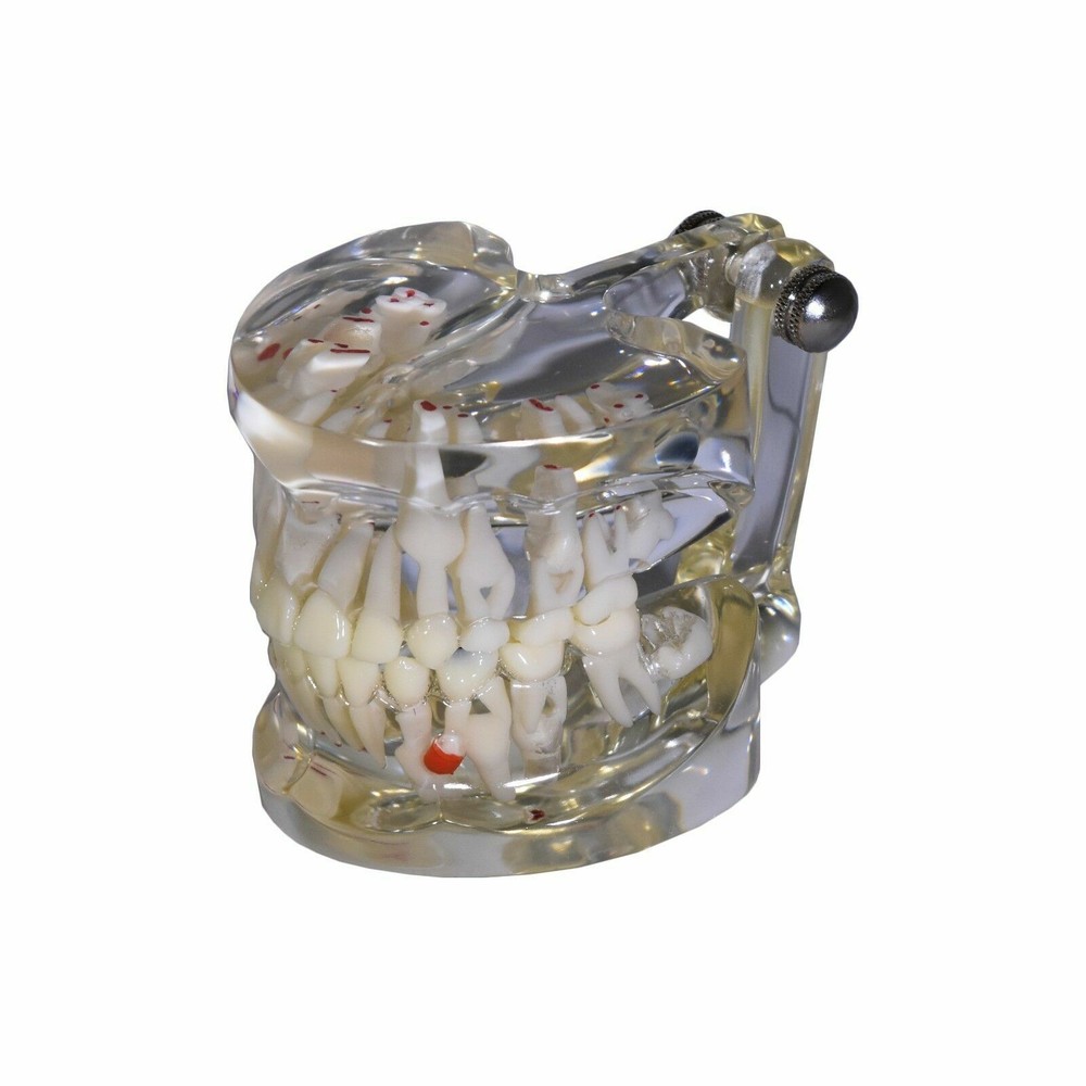 Redland Dental Demonstration Teeth Educational Model FDA