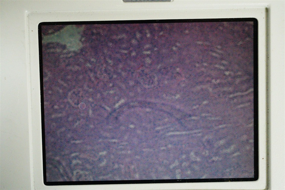 Nikon Digital Sight DS-L1 W Digital Sight DS-2Mv Camera Tested w Eclipse TS100