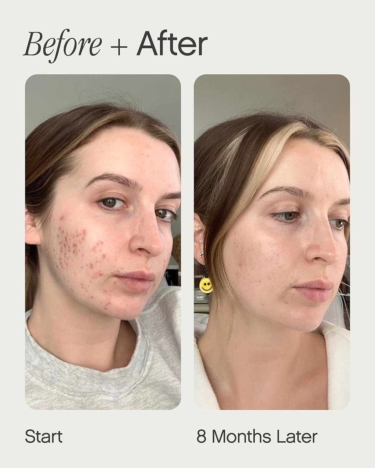 Topicals Faded Brightening & Clearing Serum Reduces Discoloration .5 oz/15ml NIB