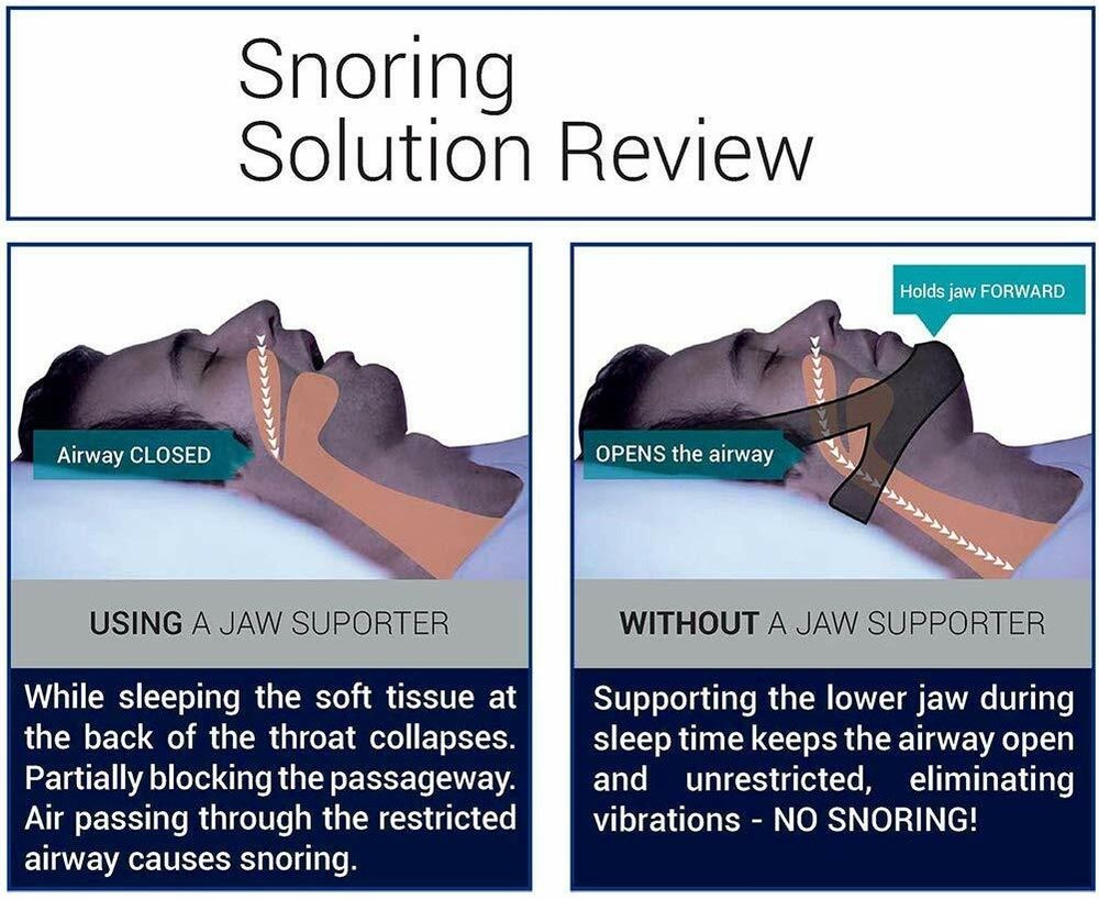Anti Snore Chin Strap Solution, Snore Reducing Aids