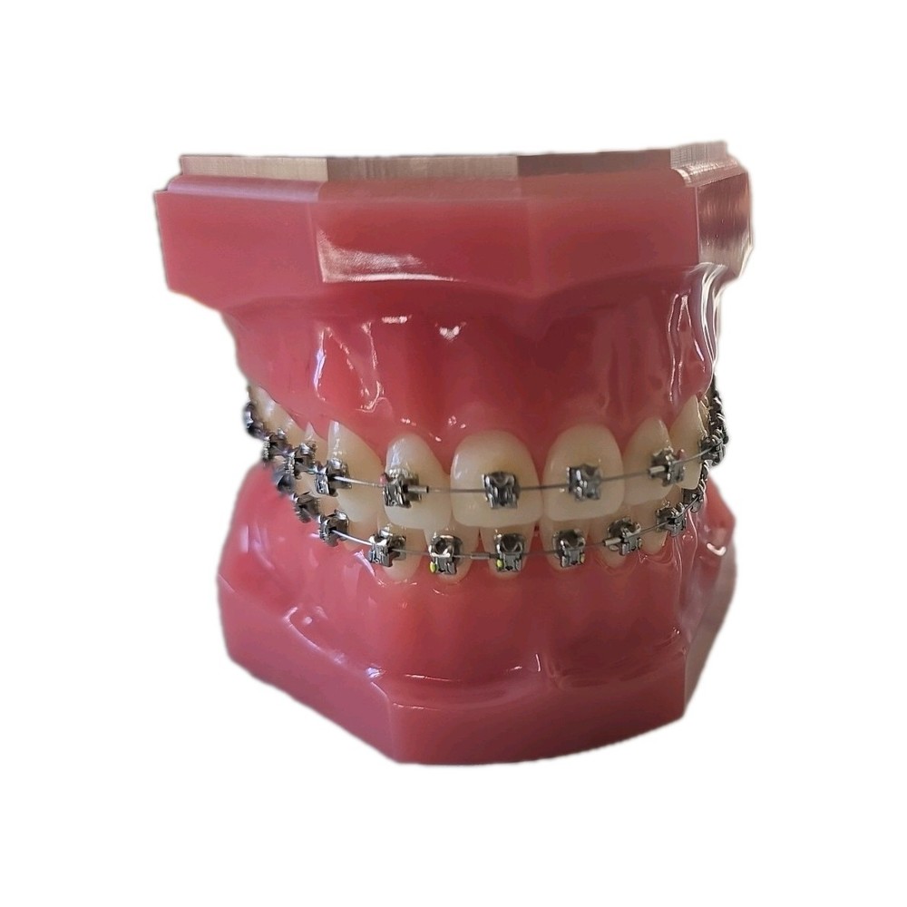 Damon 3MX Consultation Typodont 717-1033 by Ormco