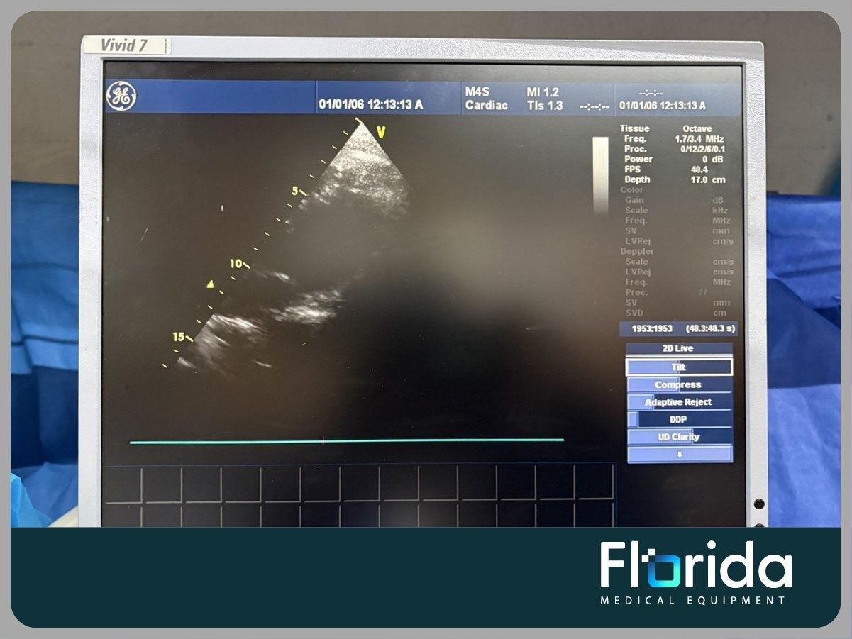 2007 GE M4S SECTOR ARRAY ULTRASOUND TRANSDUCER PROBE REF: 5129041 TESTED