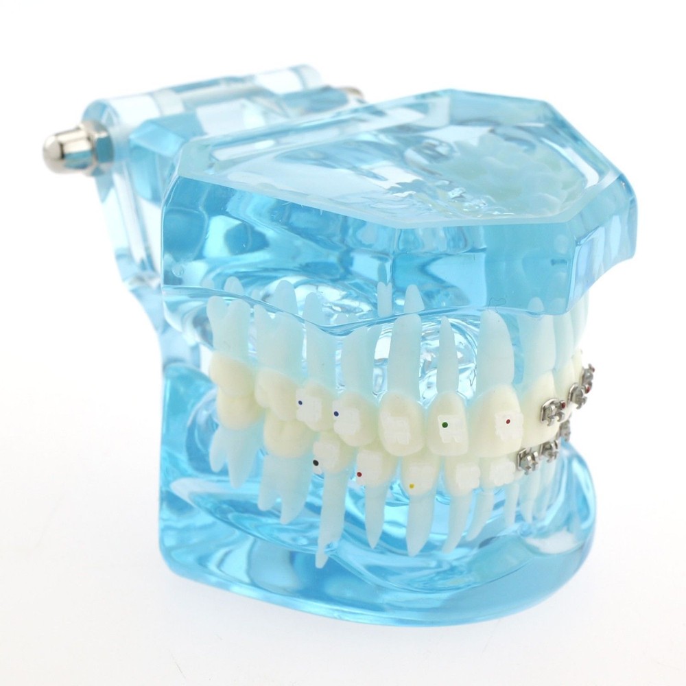 Dental Orthodontic Metal & Ceramic Bracket Brace Teeth Study Teach Model