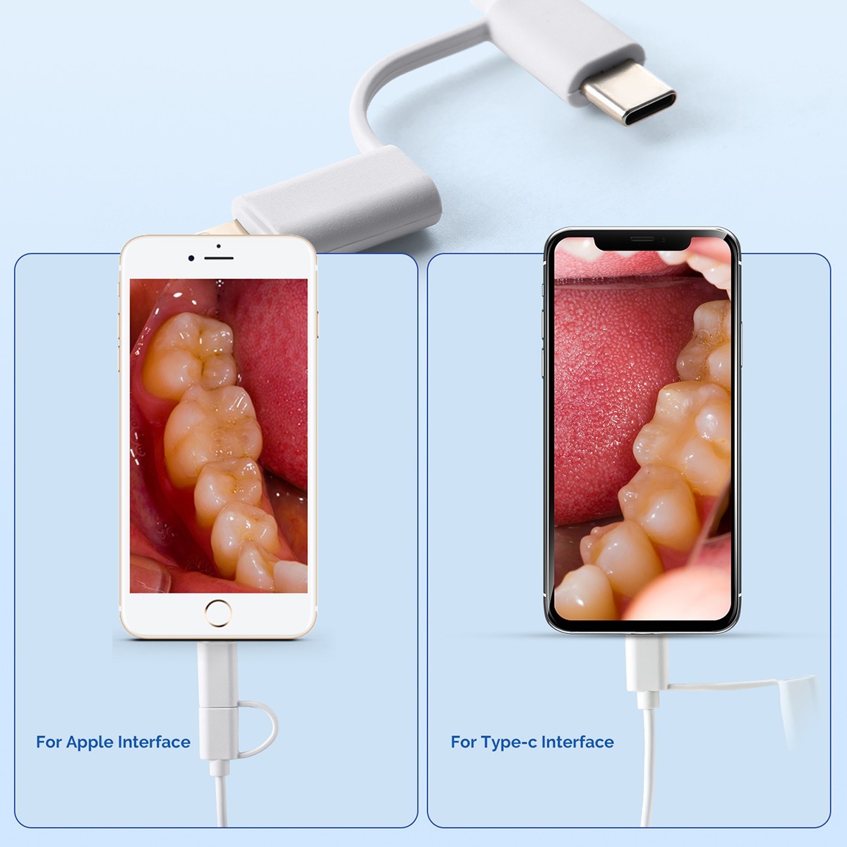 AZDENT Dental Intraoral Camera Digital USB Imaging Focus Intra Oral 8 LED Light