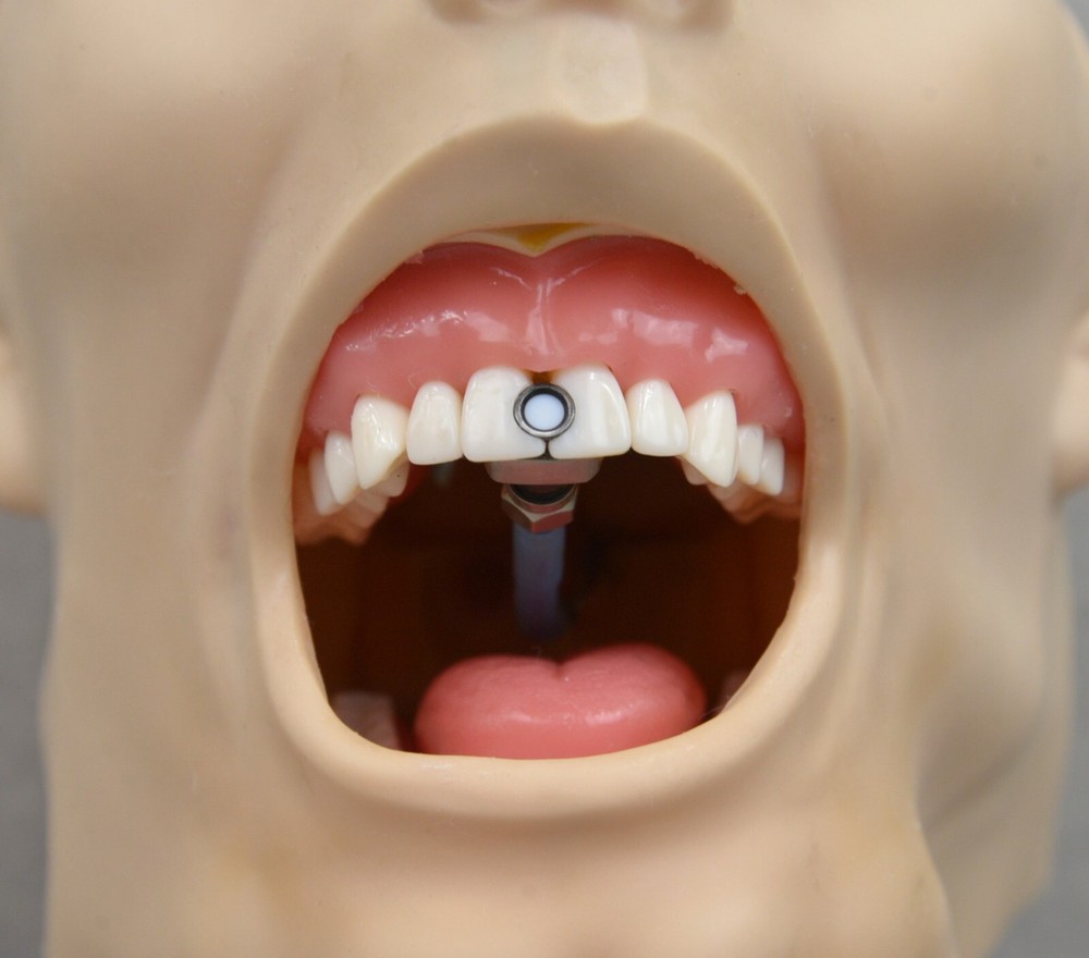 BlueLight Analytics Marc Patient Simulator Light Resin Curing Trainer