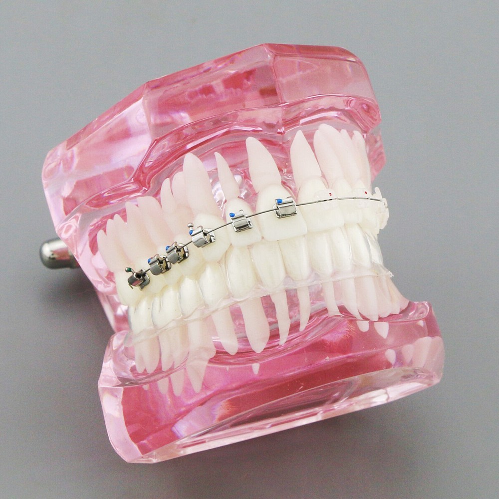 Dental Typodont Model Self-ligating Metal Bracket Ceramic Transparent Retainer