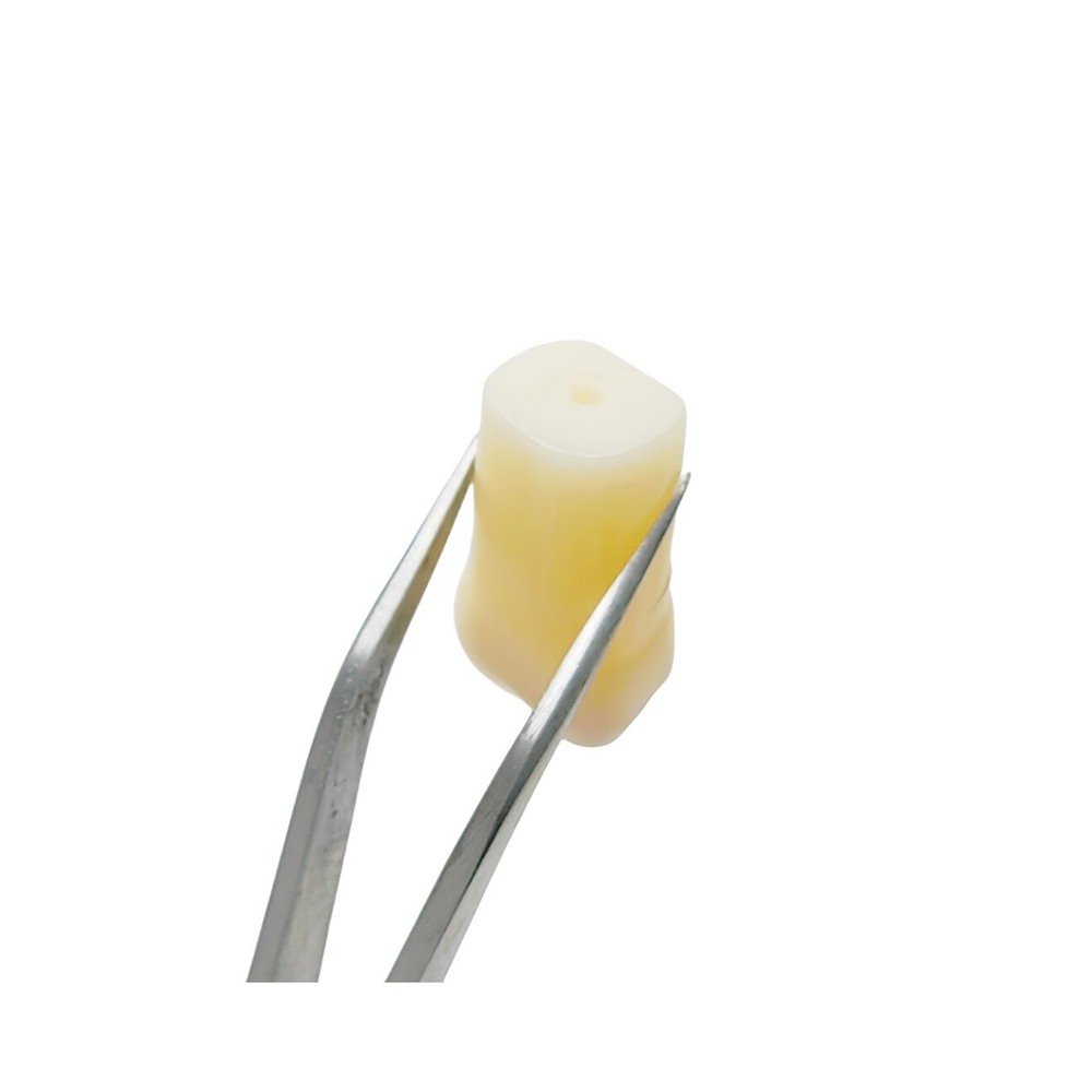 Dental Molar/Front Vitro Teeth Decay Caries Tooth Model Dentist Student Practise