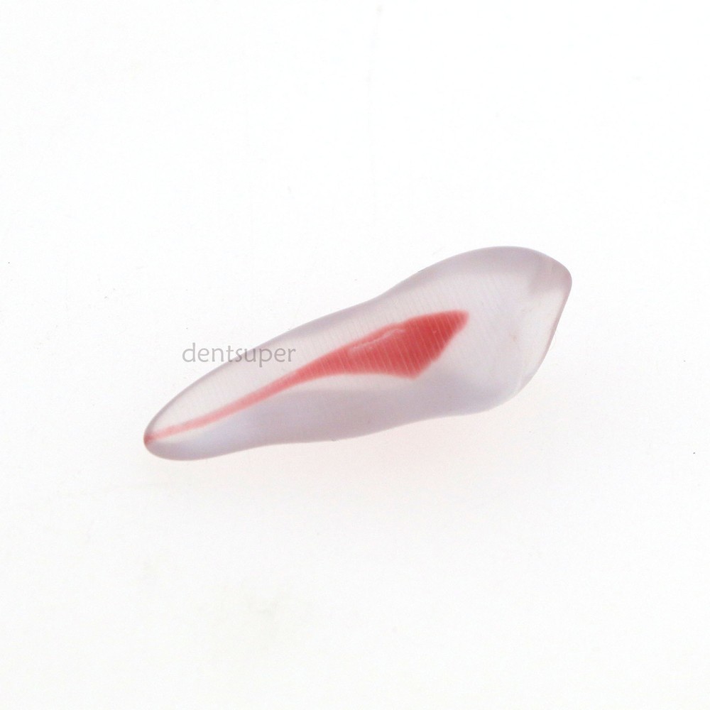 Dental Endo Root Canal Teeth Model Practice Block for RCT Pulp Cavity Study, 3D
