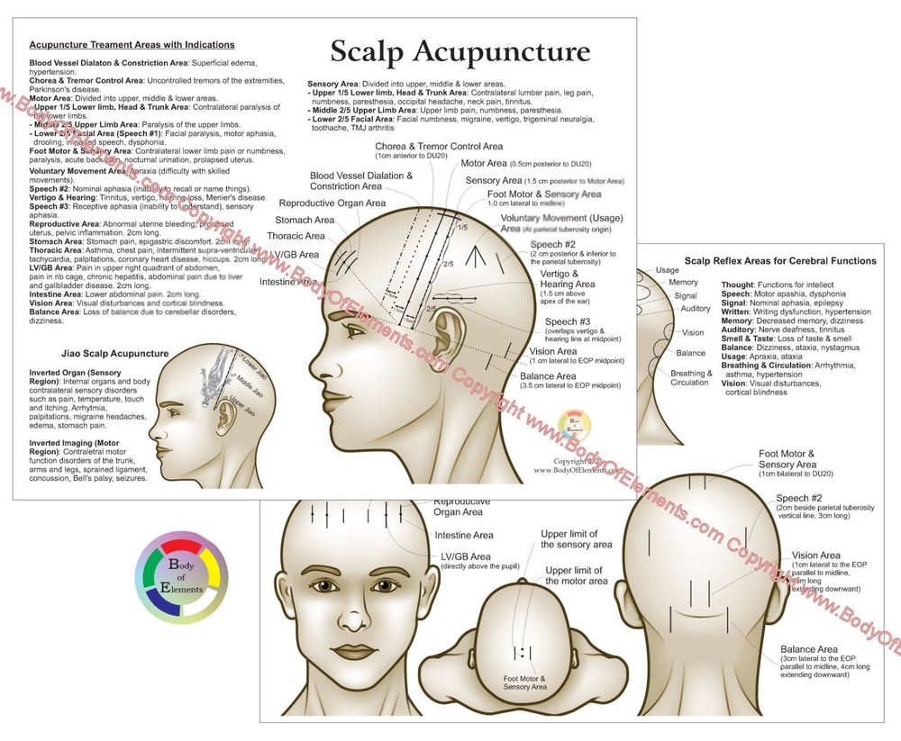 Scalp Acupuncture Points Chart 8.5" X 11" Head Microsystem
