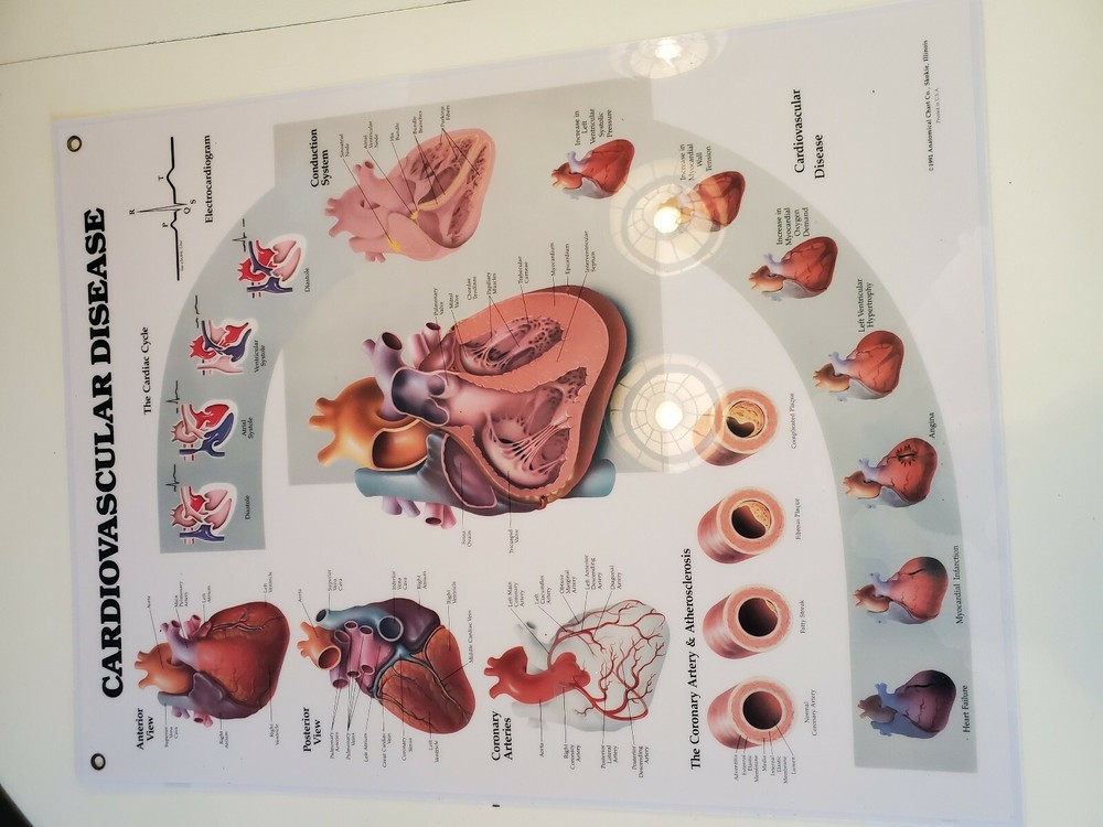 2 Medical Flip Chart Sheets Cardiovascular