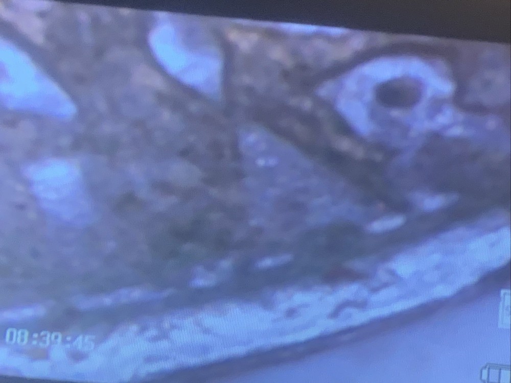 1985 P MISSING CLAD QUARTER - BOTH SIDES - 5.5 - 5.6 Grams