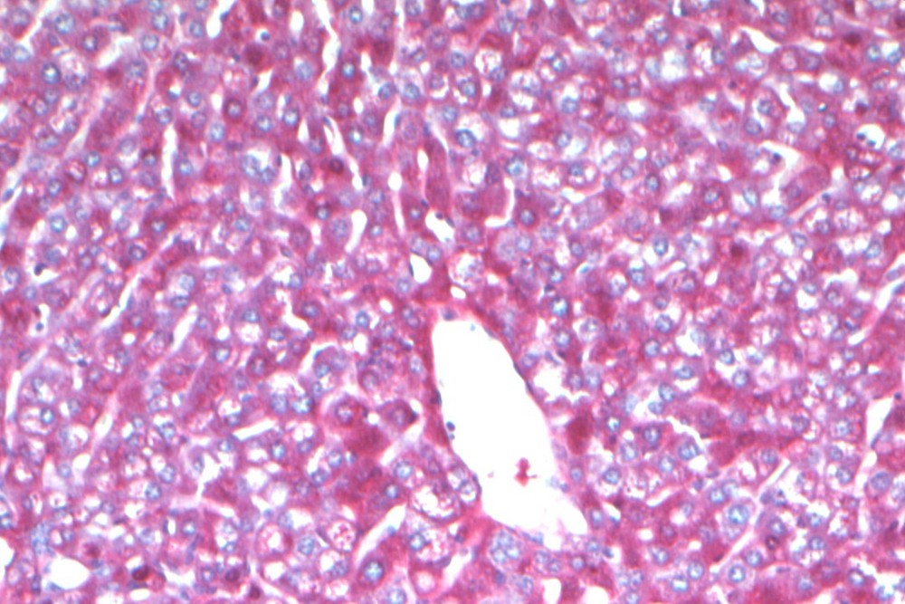 VitroView™ PAS Stain Kit (Cat#VB-3004)