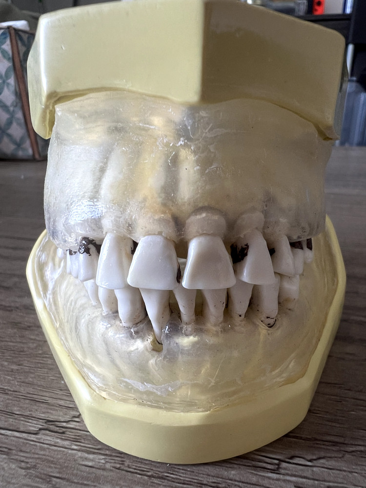 Nissin Periodontal Typodont Includes Both Upper And Lower Arch