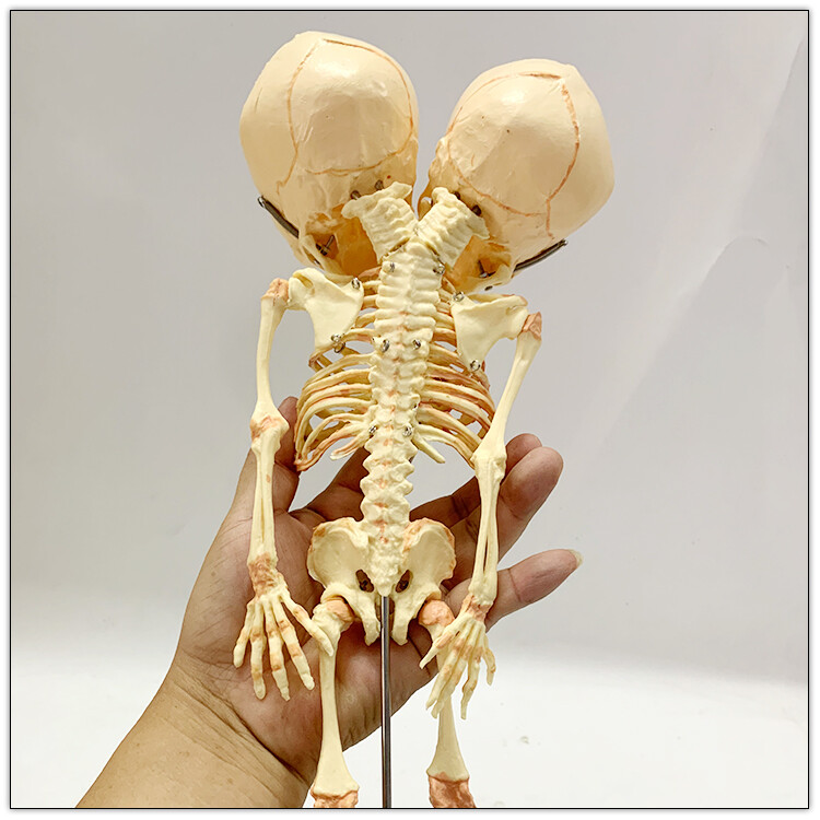 Fetal fetus Skeleton teaching educational Model Double Head Baby Skull Skeleton