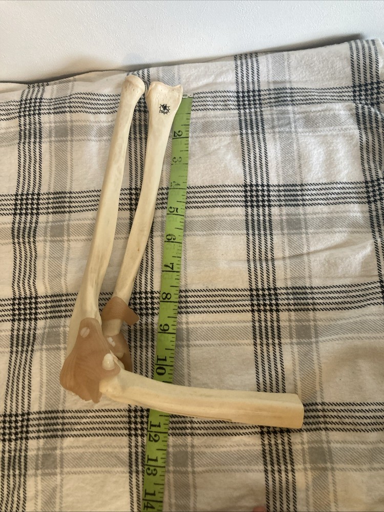 Somso Anatomical Elbow Joint Model. Read