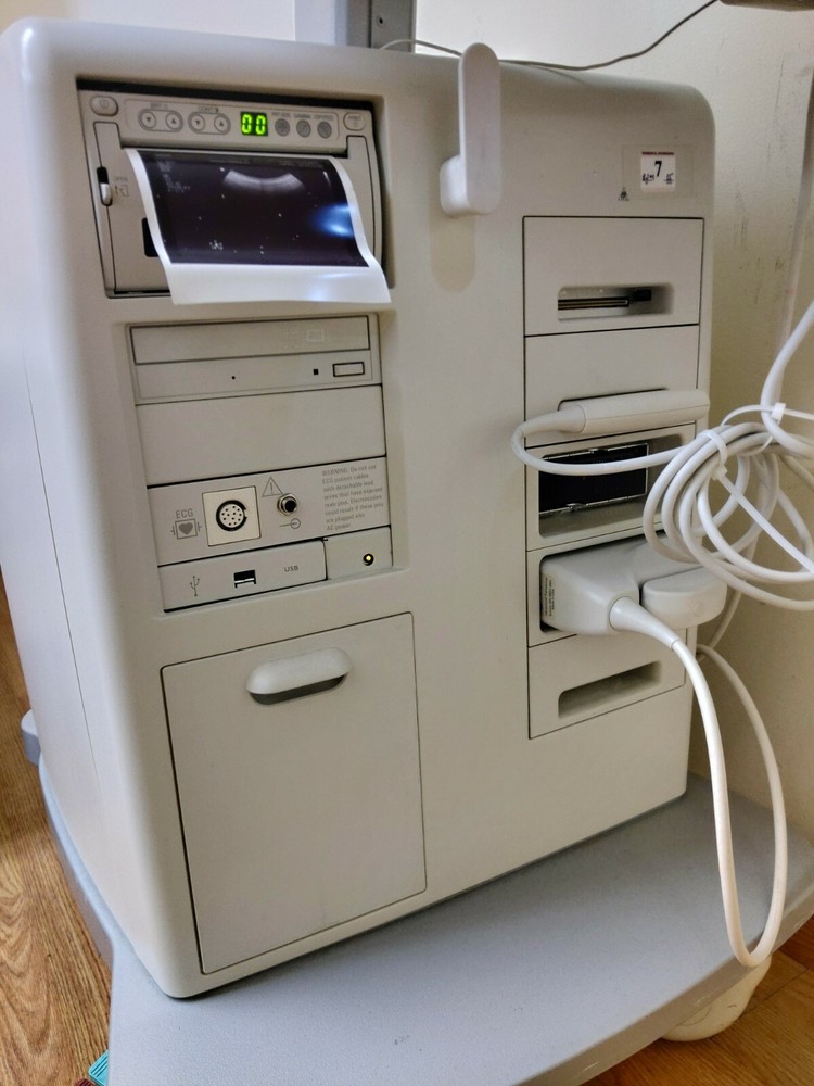 Philips HD11 XE Ultrasound